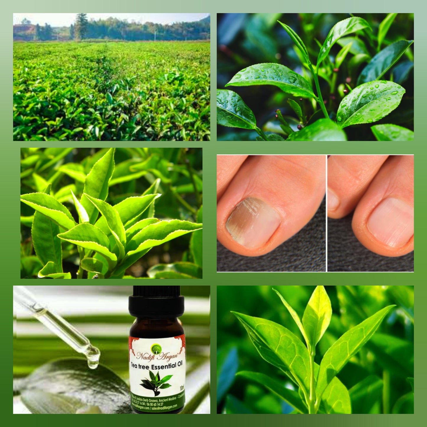 Tea Tree Essential Oil 10ml