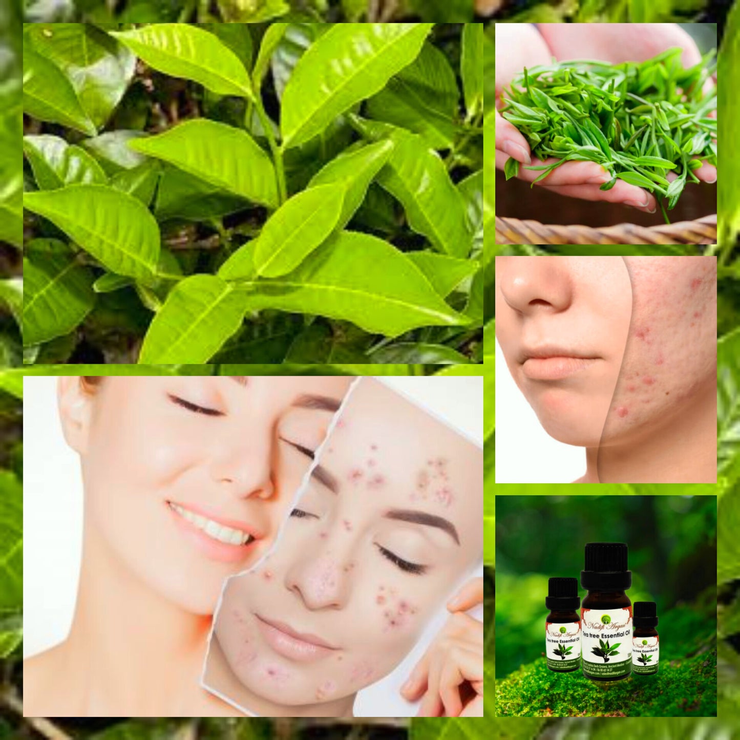 Tea Tree Essential Oil 10ml