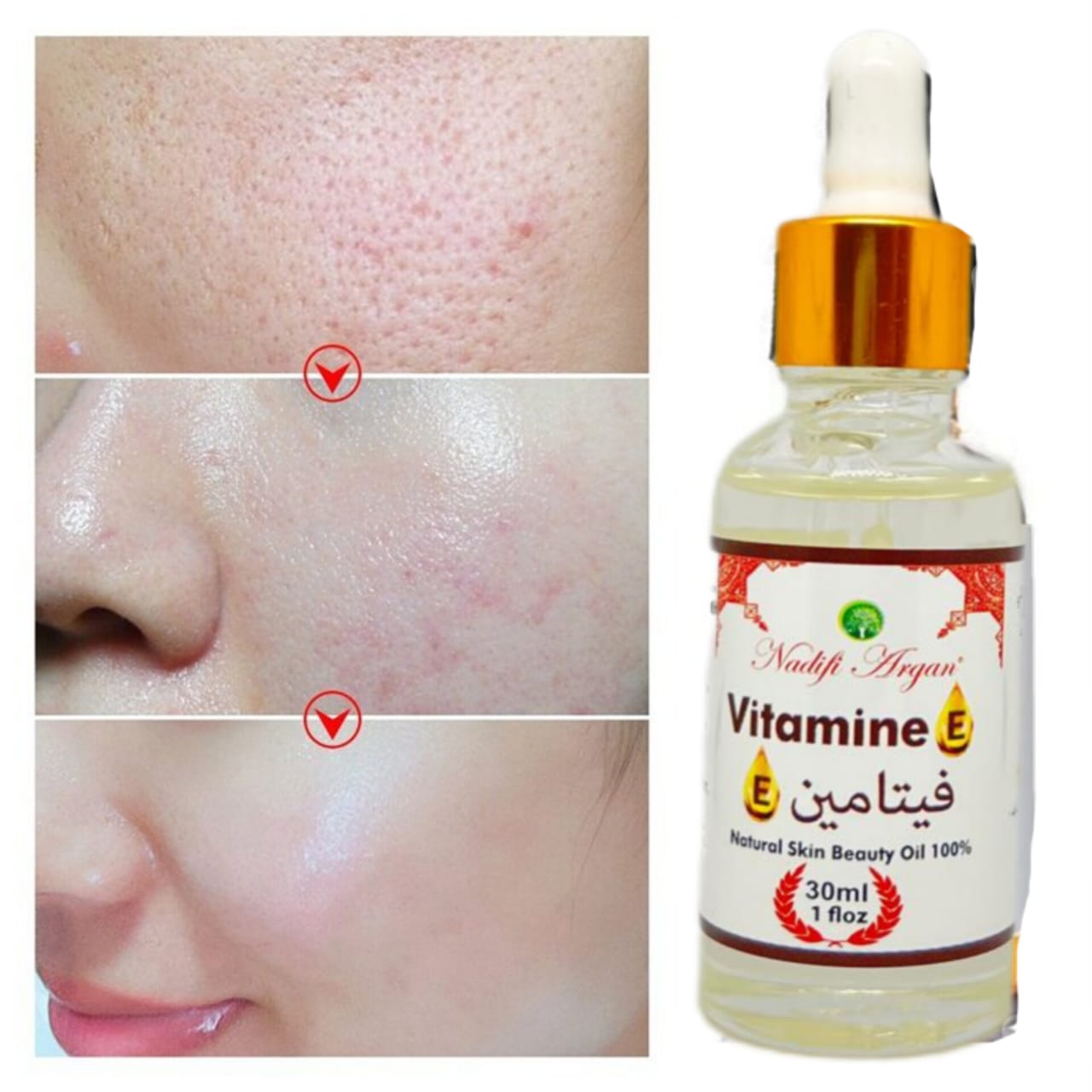 Set of 4 Vitamin E